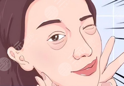 泪沟凹陷怎么解决好