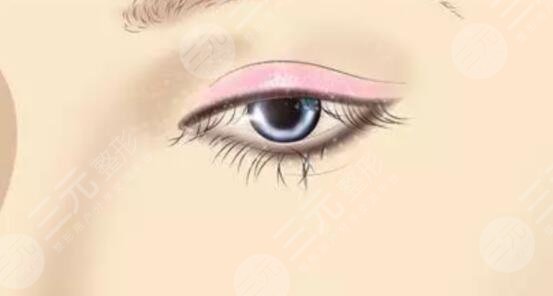 广医一院双眼皮相关信息介绍