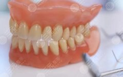 假牙有几种材质，效果和价格怎样？科普讲解2种常用体，必看！