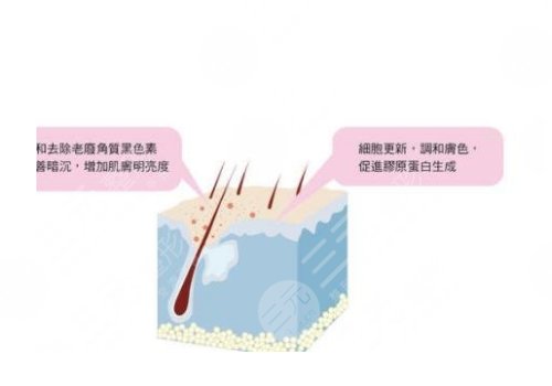 镭射净肤仪祛斑会反弹吗