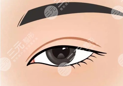 朴一飞美杜莎双眼皮