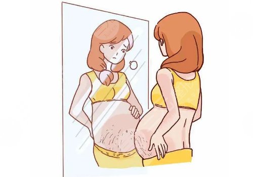 妊娠纹修复需要多少钱