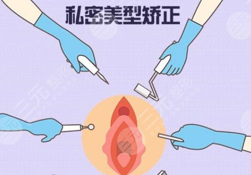 紧缩手术是怎么做的
