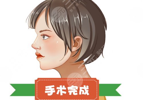 夏国兴的手术特色