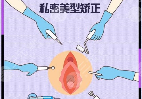 紧缩手术怎么做多少钱