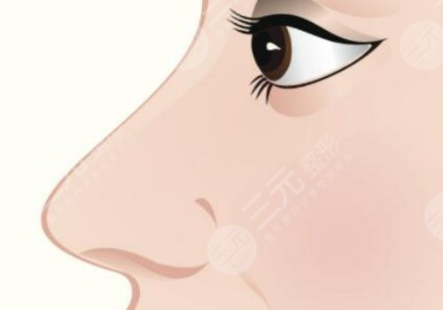 庄蔚强半勒鼻综合后期恢复怎么样