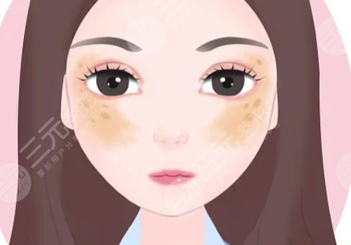 镭射净肤仪祛斑一次有效果吗