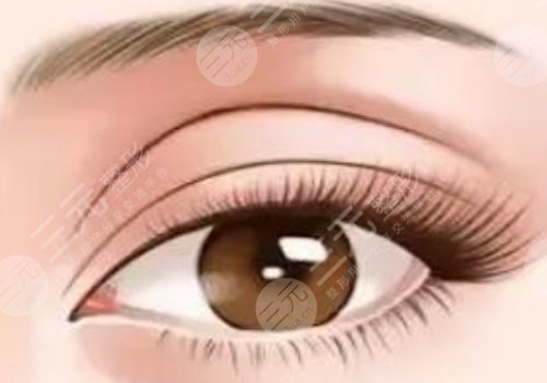 昆明李韬双眼皮案例