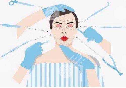 杨瑞年2023年双眼皮成功案例