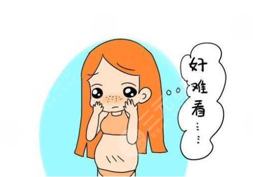 妊娠纹什么时候开始出现