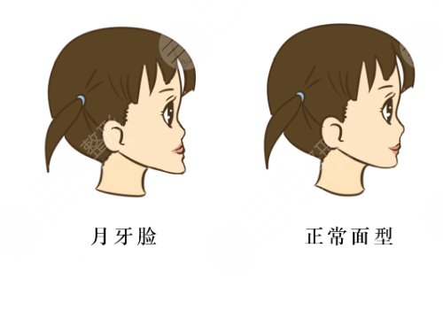 北口李自力正颌怎么样