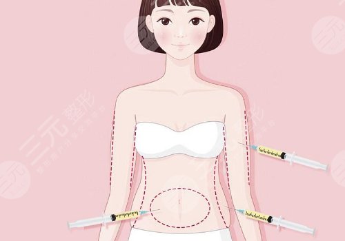 湘雅三医院王少华吸脂怎么样