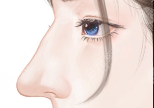 湖南省人民医院李高峰鼻子做的怎么样