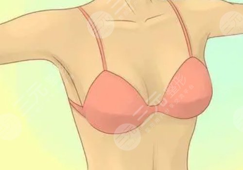 胸下垂做悬吊的前后比较