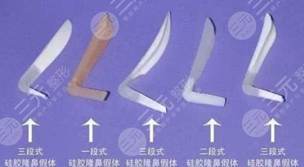 张金辉医生隆鼻手术案例