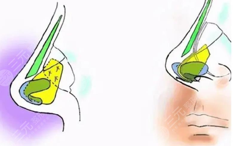 北京美莱医疗美容医院擅长项目