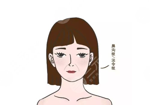 微创除皱手术价格是多少