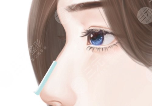 成都徐航做鼻子好吗