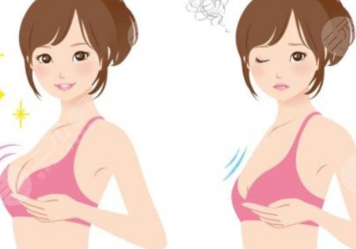 肖鸿医生做脂肪移植怎么样