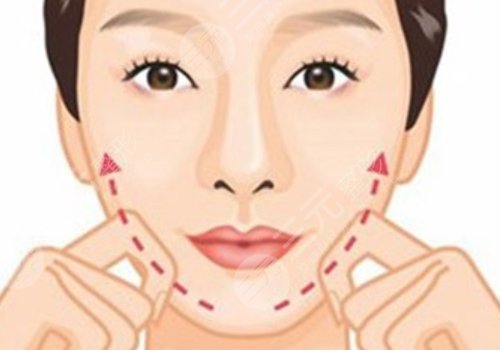 于艳菊医生取生长因子吗