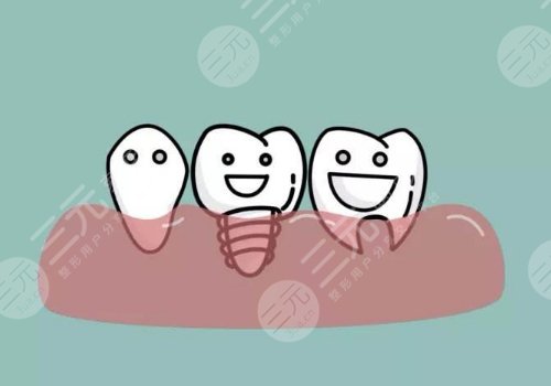 北京安贞医院口腔科种植牙怎么样