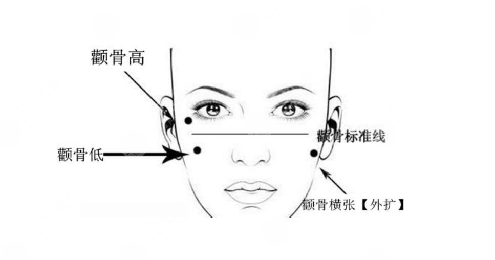 颧骨颧弓手术一般在什么价位