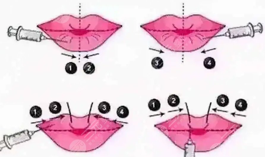 华西医院整形科价目表新2023