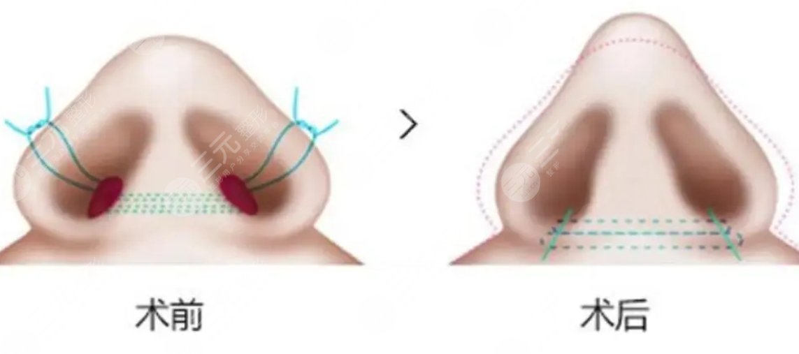 华西医院整形科价目表新2023