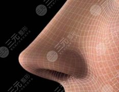 鼻梁注射玻尿酸怎么样，有没有风险？隆鼻避坑指南~