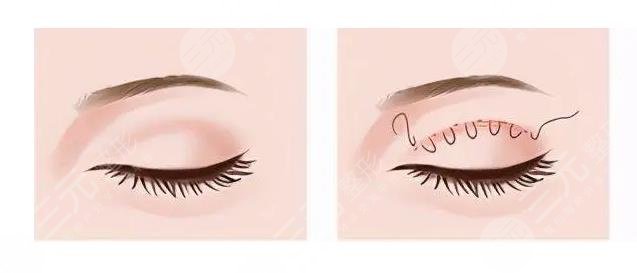 上海九院整形科坐诊医生信息