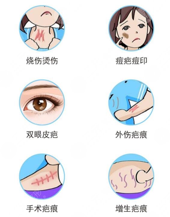 上海第七人民医院整容科疤痕修复案例参考