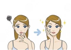 去色素沉着好的方法有哪些？光子嫩肤、激光治疗都还不错哦！