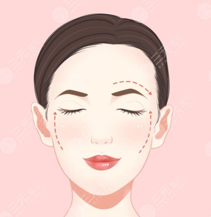 周敏茹医生脸上微调怎么样?