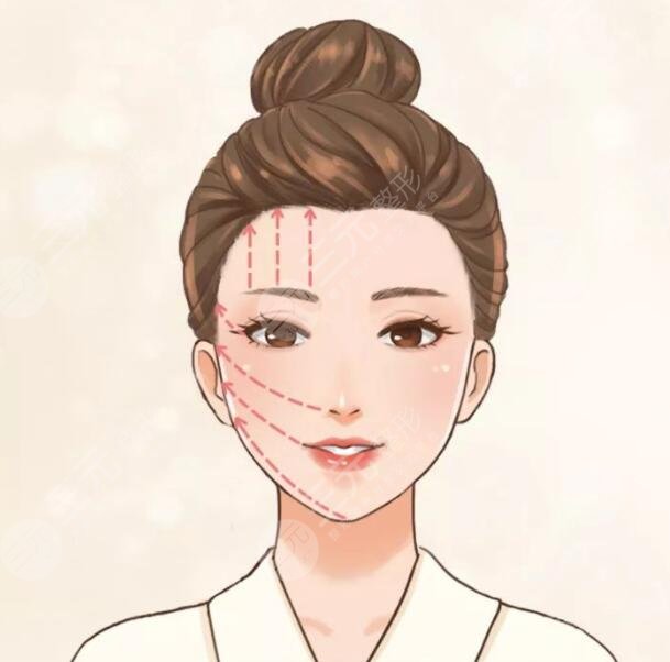 周敏茹医生脸上微调案例