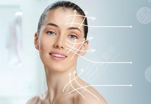 李晓东医生面部提拉案例