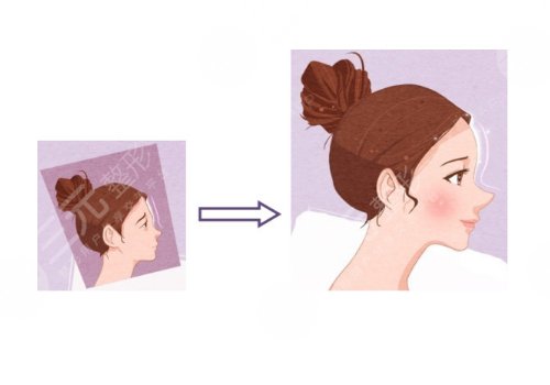 额头填充一般维持多久