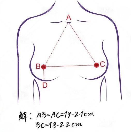 王沛森医生丰胸案例反馈