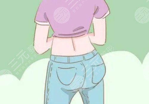 填充臀部一般多少钱