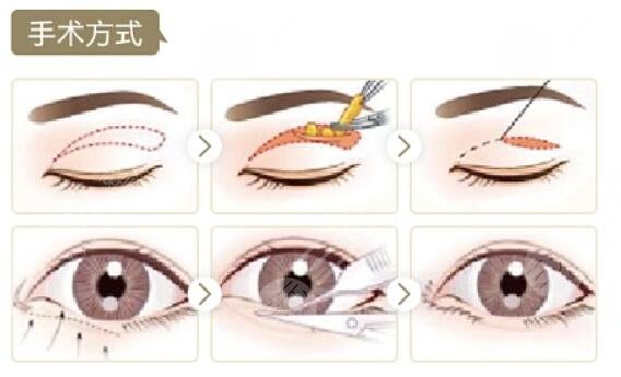 湖南省人民医院罗滔和李波哪个可以？