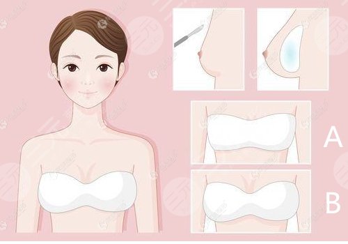 傲诺拉和曼托的区别在哪里