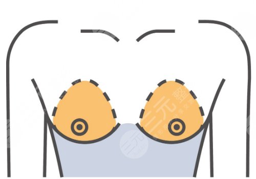 傲诺拉和曼托的区别在哪里