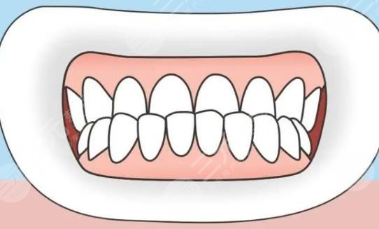 地包天牙齿