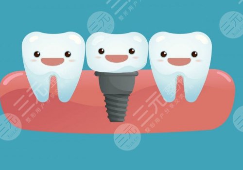 正常种一颗牙多少钱