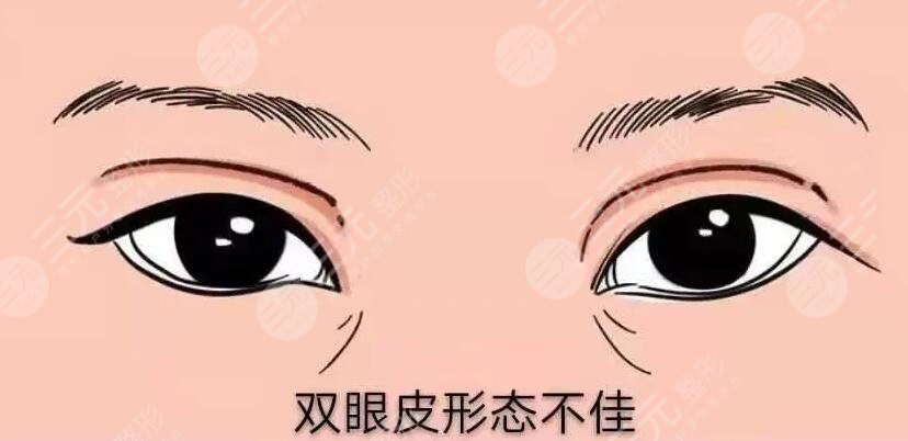 北京韩勋眼修复案例分享