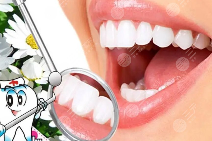 牙齿美白