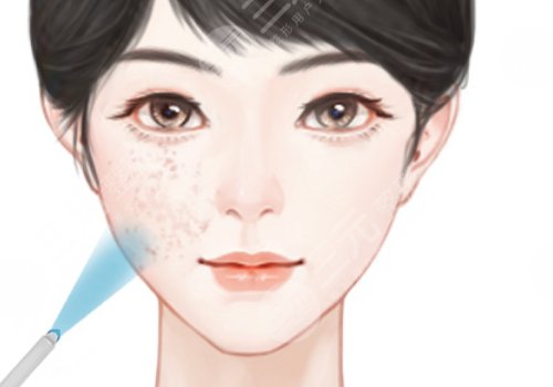 浙江医院整形美容科做皮秒要多少钱