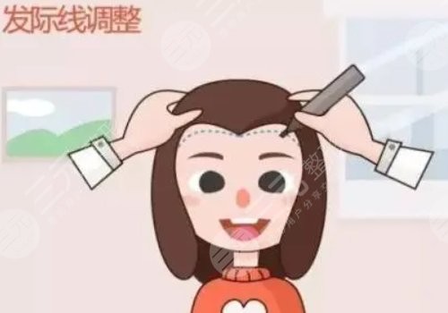 汤宋佳植发怎么样