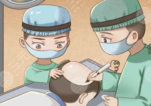 汤宋佳植发怎么样