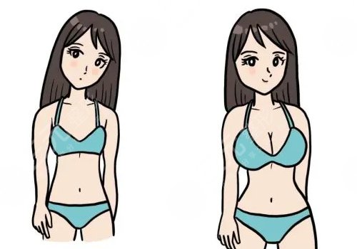 同济叶子荣隆胸怎么样