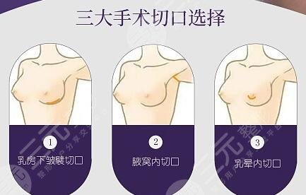 美国麦格假体隆胸价格是多少钱?2024年有所调整,不再是富婆专属!